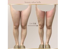 ベル(belle)/足before after