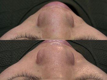 リアン 本町(Lien.)/敏感肌も対応可能！！