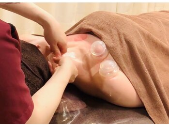 オリエンタル ルボワール(oriental Revoir)/筋膜リリースカッピング