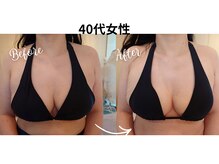 サロンハナ(Salon HANA)の雰囲気（ベテランの技術＋光＋ナノカレント効果で戻らないバスト¥14800）