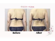 エス(es)/あなただけのブレンドオイルで