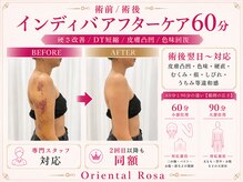 オリエンタルローザ 表参道(Oriental Rosa)