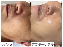 フォー(For...)の雰囲気(Optyl高密度超音波|天王寺◇50代のシミケア/毛穴ケア得意◎)