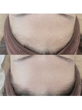 アイラッシュサロン キー(Eyelash salon KEY)/フェイシャルWax脱毛