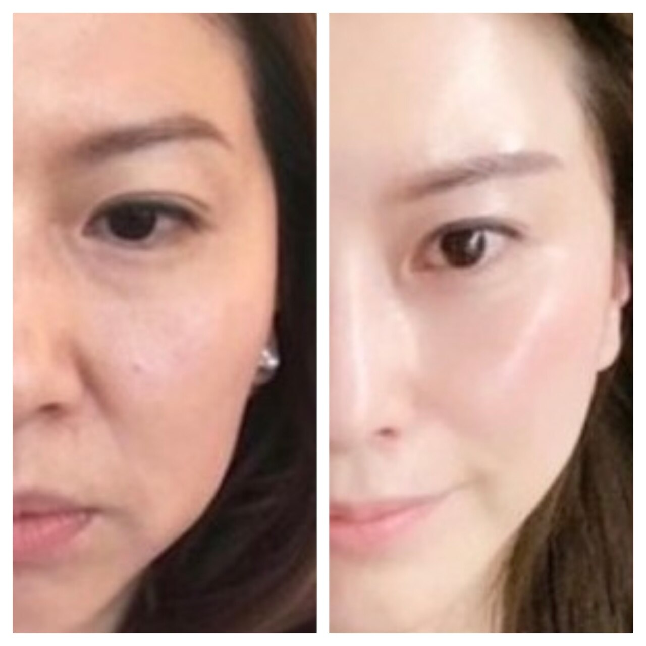 フォト｜ベル(Bell)｜ホットペッパービューティー