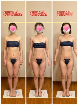 トータルボディセラピーハート(Heart)/バストアップと痩せるが同時に！