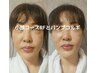 【究極エイジング】小顔コルギ背中＆ヘッド付100分★たるみ・ほうれい線ケア