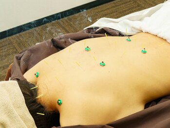 アキュピタル(acupital)/一般鍼灸の流れ4 鍼灸