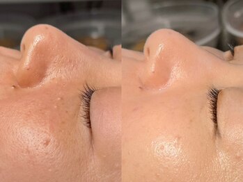 ルーナジェーナ(Luna llena)/