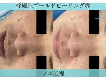 リメイククリニカルビューティー(Remake clinical beauty)/