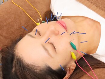 堺整骨院 三苫院の写真/年齢を重ねるごとに気になるお肌のお悩み。そんな繊細なお肌の変化に、丁寧に向き合うのが“美容鍼”です◎