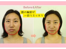 円山カラダ/顔の輪郭が一回りスッキリ