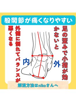 ニコ(niko)/足元のバランスを崩しています