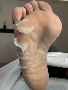 ネイルサロンアンドスクール ペルシャ(Persia)の写真/巻き爪ケア角質ケア特化サロン!巻き爪、魚の目、タコケアが大人気!つるすべ赤ちゃん足に近づけます♪