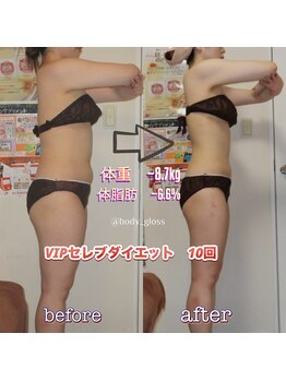 ボディグロス 梅田店(BODY GLOSS)/VIPセレブ10回ー8.7kg