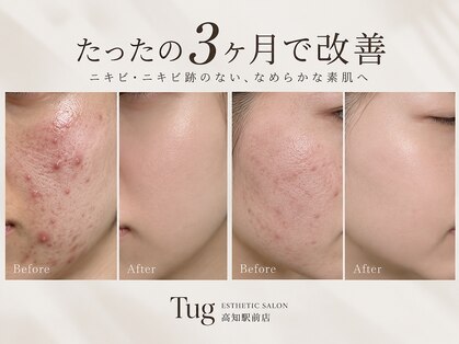 タグ 高知駅前店(Tug)の写真