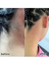 ルナソル 昭島店(LUNASOL)/うなじWAX脱毛