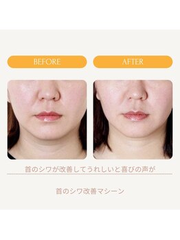 ムーンライズ(moonrise)/