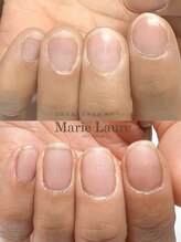 マリーロール 梅田店(Marie Laure)/深爪矯正/自爪育成/ネイルケア