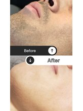 ラッシュ(RUSH)/1年2ヵ月でで完了！