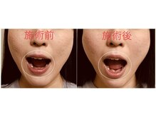 小林整体院 銀座/顎関節の問題も施術で改善します