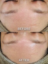 ルーク(Luke)/くすみケア