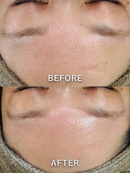 ルーク(Luke)/くすみケア