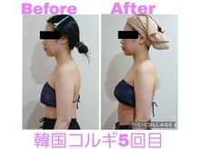 ルル(Ruru)/韓国コルギ/5回目