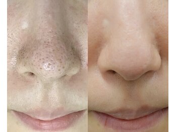 スリリアン 銀座/★お客さまビフォーアフター★