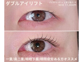 ザ ベッピン(the 別嬪)/ダブルアイリフト