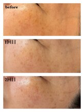 アウラ 砺波店(AULA)/ララピール