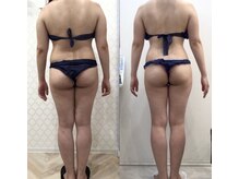 リラパドマ 千葉店(Rela Padma)/激痩せ短期集中ダイエットコース