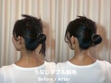 メローワックス 横浜店(MELLOW WAX)/【横浜駅/脱毛/ワックス/光】