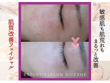 リヴェーヌ 富山店