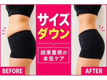 ヨサパーク アンジュ 千早店(YOSA PARK Ange)の写真/「年齢とともに落ちにくい脂肪にアプローチ！」食事制限、運動なし、座るだけのダイエット！