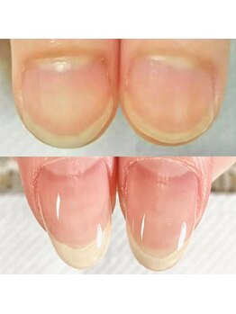 アティラン(Attirant)の写真/【爪の悩みが解消できる】短い/平たい爪もプロの補正技術で縦長美爪へ★指先補正技術/美フォルムはお任せ◎