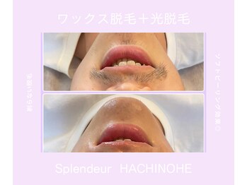 スプランドゥール 八戸(Splendeur)/ひげ脱毛