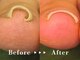 わたなべ接骨院の写真