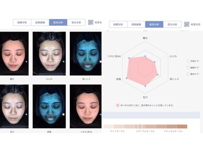 ウニ(uni)の写真