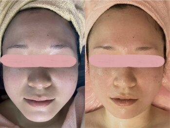 美容整体カラダリメイク(karada)/小顔矯正も人気です！