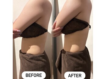 リアンアンドミー(Lien&me)の写真/【鳳駅徒歩５分】美シルエットを徹底追及！部分&全身シェイプやヘッドリンパで身体の巡りから整えます★