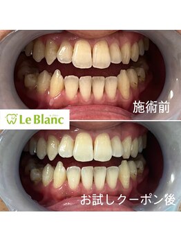 ルブラン 奈良店(Le Blanc)/男性のお客様も増えています!