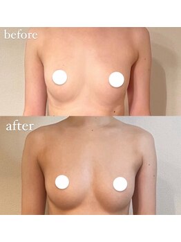 アウーム(a Womb.)/ヌードバストの形に拘っています