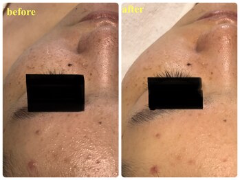 ベルドア(Bell Door)/肌改善