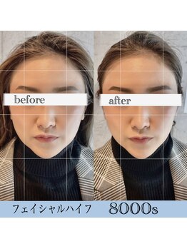 ダブリュー アイプラス 明石店(W eye+)/