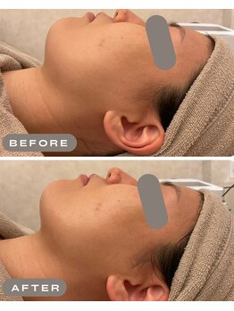 リノ 西宮北口店(Lino)/