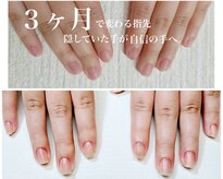 ネイルサロン ラピエトラ(la pietra)