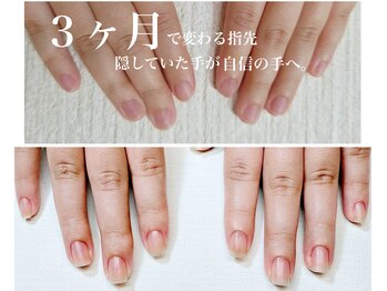 ネイルサロン ラピエトラ(la pietra)