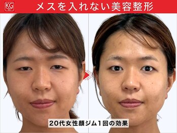 那賀洋子式 顔ジム 大分戸次店/20代女性顔ジム1回の効果