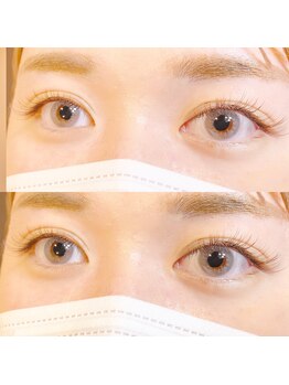 ビューティーホスピタル(Beauty Hospital)/オシャレeye☆